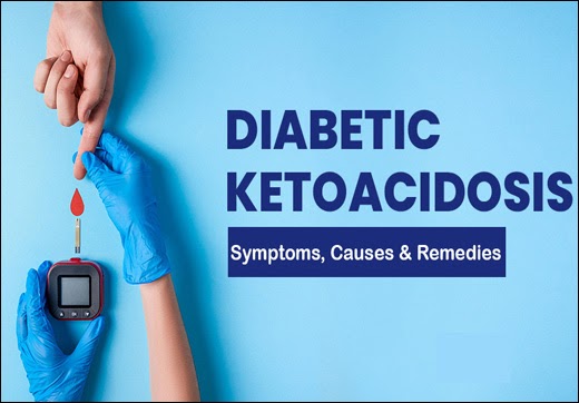 Alternative Treatment For Diabetic Ketoacidosis With Herbal Remedies - Dr. Vikram's Blog