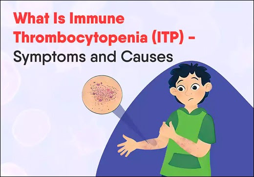 How ITP (Immune Thrombocytopenic Purpura) Can Be Treated in Ayurveda? - Dr. Vikram's Blog
